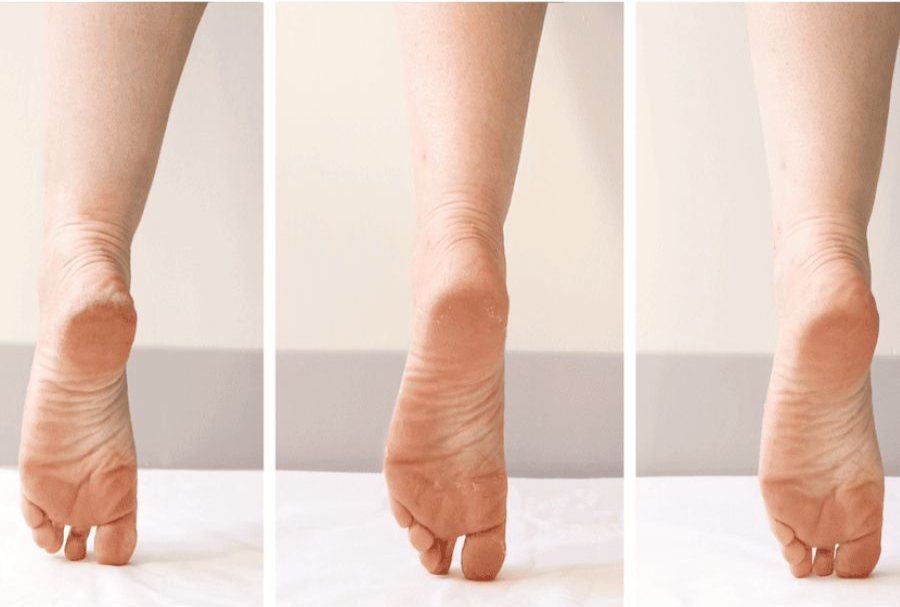 Why Your Feet Look Dry After Winter (and How to Fix It Before Sandal Season)