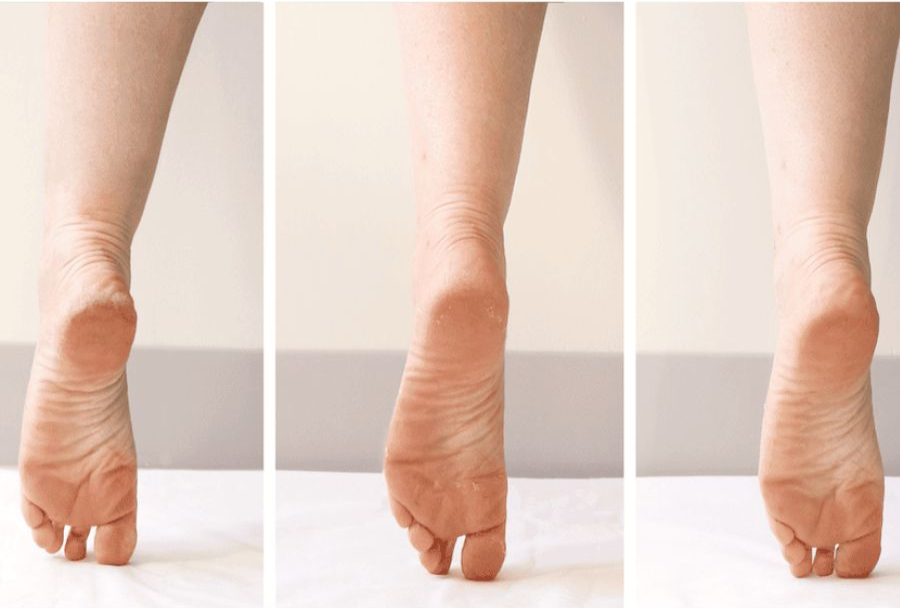 Why Your Feet Look Dry After Winter (and How to Fix It Before Sandal Season)