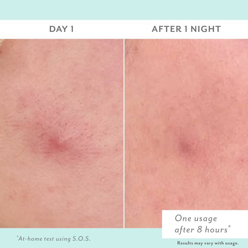 Before and after comparison of skin treatment on Day 1 and After 1 Night.