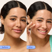 Before-and-after split screen showing a woman's face with freckles, demonstrating the effects of a skincare product. The left side is labeled 'before' and shows more freckles, while the right side is labeled 'after' and shows a clearer, more even complexion.