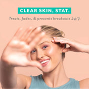 Woman with clear skin on a beige background with text 'Clear Skin, Stat.'