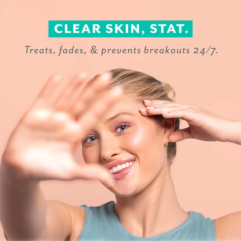 Woman with clear skin on a beige background with text 'Clear Skin, Stat.'
