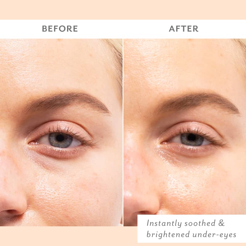 woman visibly smooth under eyes before dark circles and puffy skin after hydrated and glowing skin instantly soothed and brightened under-eyes