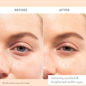 Before and after comparison of under-eye area with text 'Instantly soothed & brightened under-eyes'.